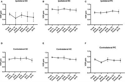 Changes in Vestibulo-Ocular Reflex Gain After Surgical Plugging of Superior Semicircular Canal Dehiscence